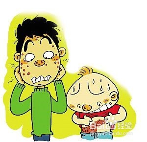 孩子得了水痘在家怎么护理