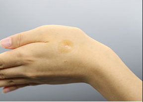 塔式艾灸怎么用？塔式艾灸使用指南