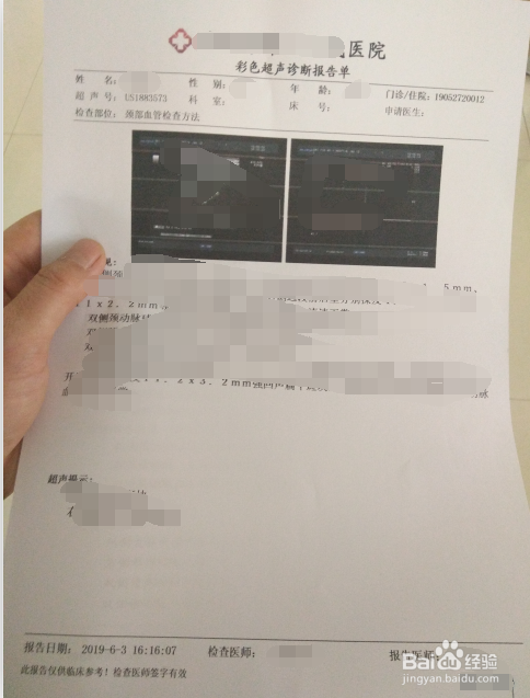 做颈动脉彩超的流程