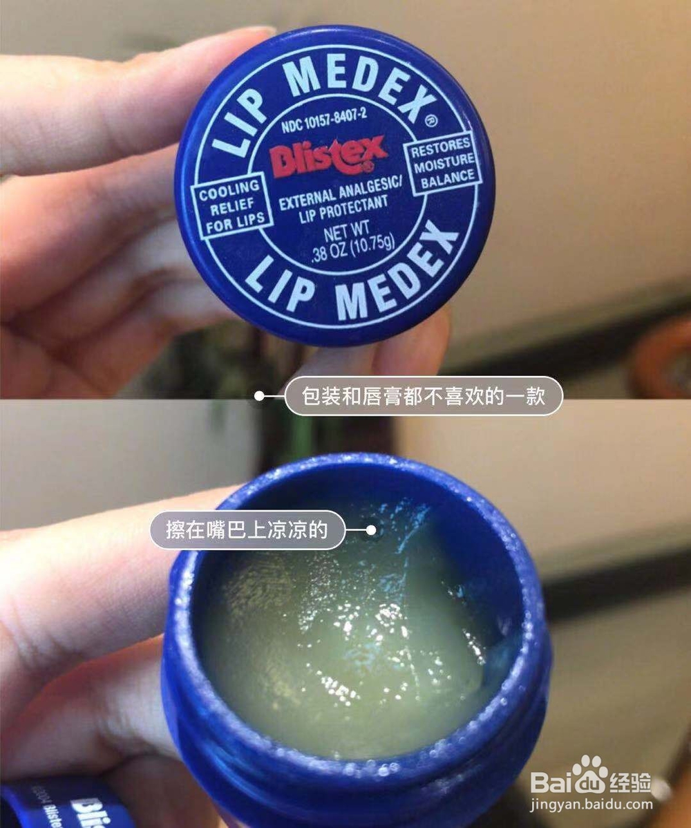 嘴唇脱皮怎么办？