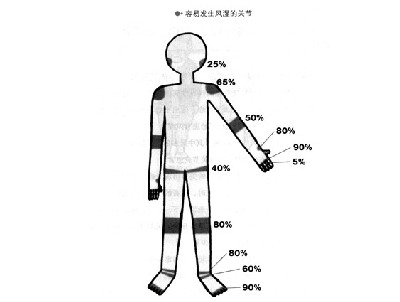 户外活动中造成膝盖病症的原因及对策