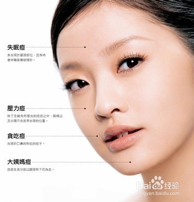 了解自己脸上的某个部位长痘痘的原因