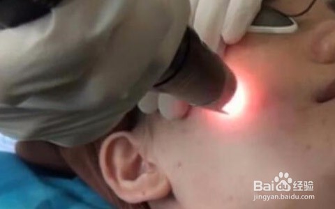 医学祛斑有哪些方法？医学祛斑价格多少？