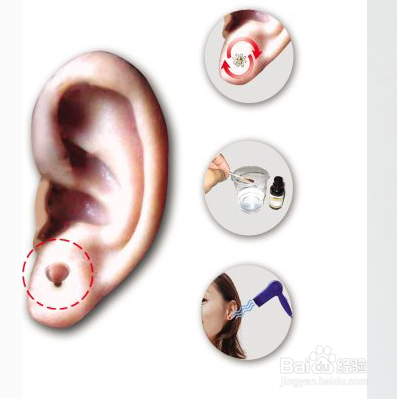 打耳洞后的一些注意事项
