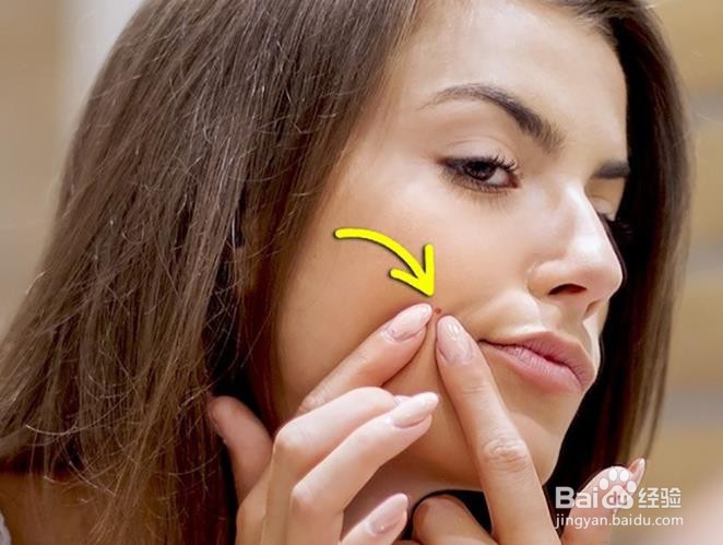 女性荷尔蒙不平衡的表现