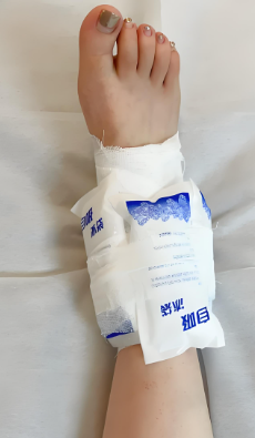 扭伤后是热敷还是冷敷？