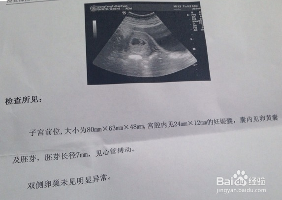 怀孕产检时间及主要项目