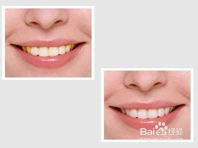 牙齿变白的小方法