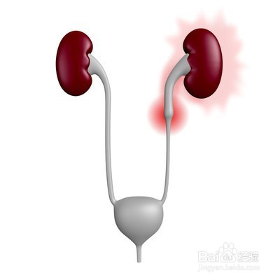 哪类人群不宜喝牛奶?