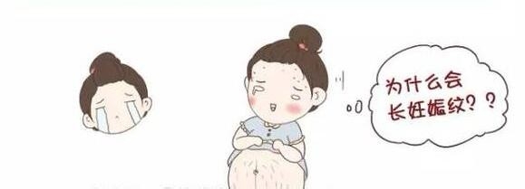 妊娠纹怎样预防