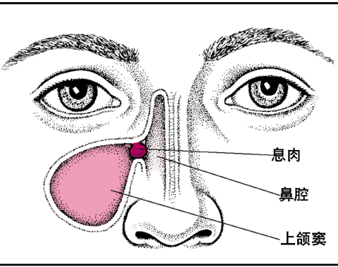 怎样认清手术和过敏性鼻炎的关系 百度经验