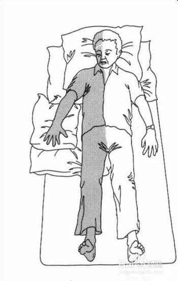 如何预防褥疮