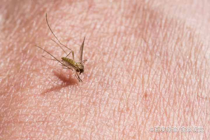 脚底被蚊子咬怎么止痒