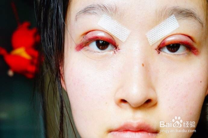 内双能割双眼皮吗