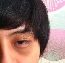 “低头族”要小心3大老化症