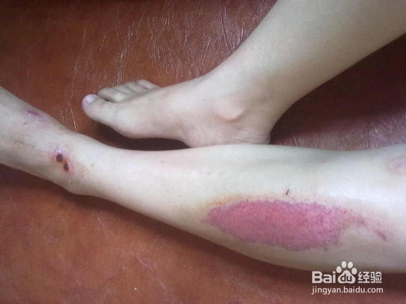 老人泡脚应该要注意的事项