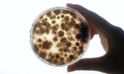 观察霉菌的实验步骤