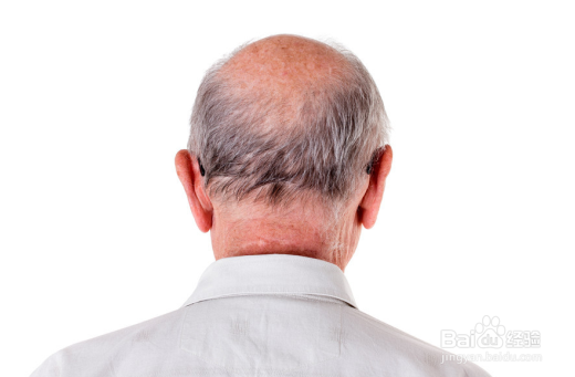 冬季治疗脱发经验和生发方法