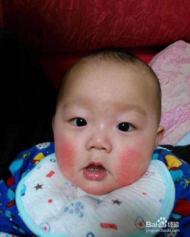 怎样快速修复过敏