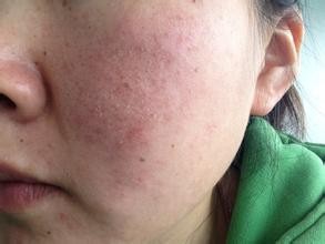 孕妇自制补水面膜,怀孕也能那么美!