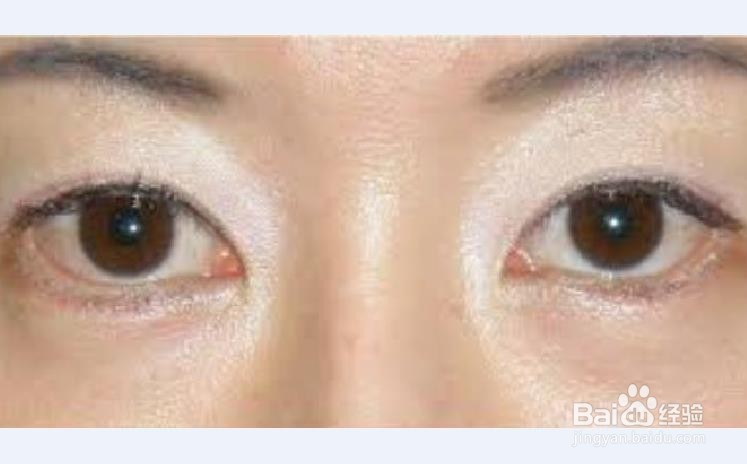 生活中怎样做好眼睛的保健