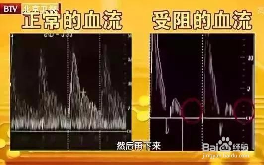 怎样自测以及治疗宫寒