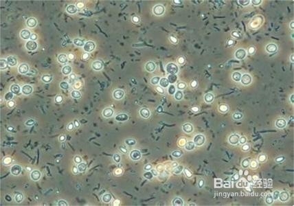 生活垃圾除臭的方法