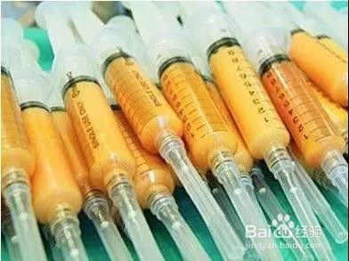 躲开自体脂肪隆胸危害 嫉妒使我丑陋 百度经验 躲开自体脂肪隆胸危害 嫉妒使我丑陋 百度经验