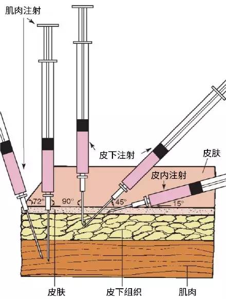 胸椎的英文简写是什么，是T吗，颈椎的英文缩写是C吗，腰椎的英文缩写是L吗