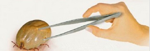 防止蜱虫叮咬小妙招与处理方法