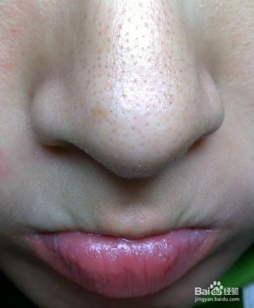香蕉面膜去黑头方法 百度经验 香蕉面膜去黑头方法 百度经验