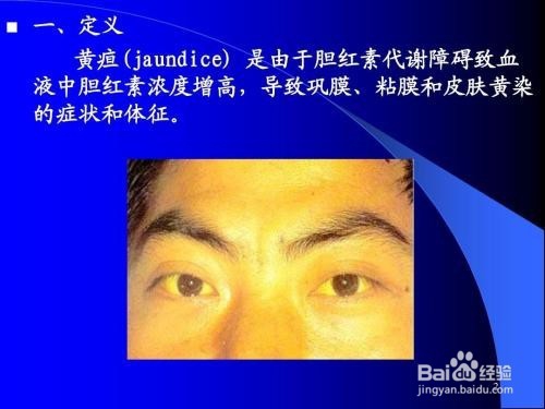 怎么看肝检验报告