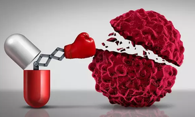 常见肿瘤转移途径汇总？金雀异黄素怎么样