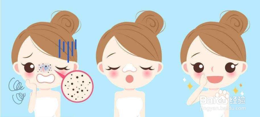 如何解决脸上的黑头和白头