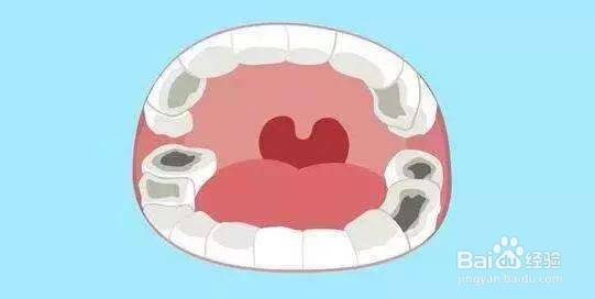 牙齿发黄还有黑垢，是怎么导致的？