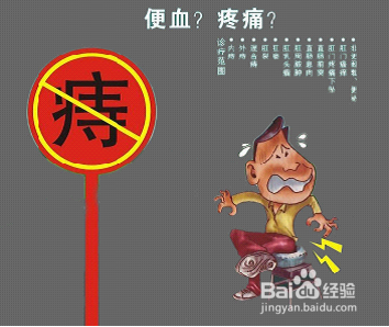 外痔的预防与治疗