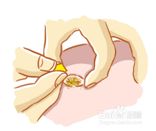 护理新生宝宝脐带需要注意什么