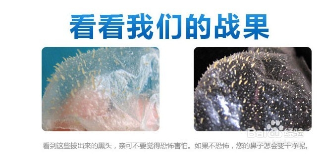去除黑头最有效的方法