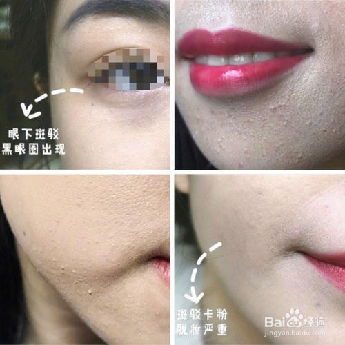 化妆起皮卡粉怎么处理