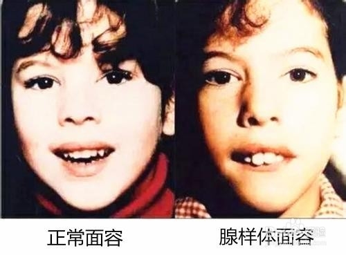 孩子长大变”丑“,有可能就是父母忽视了这一点