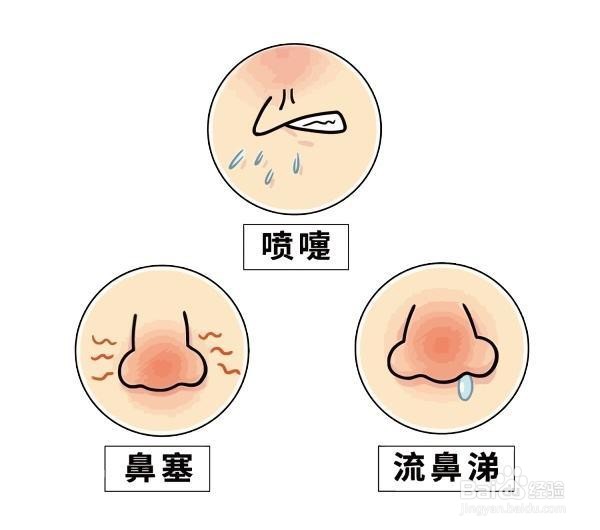 怎么预防过敏性鼻炎