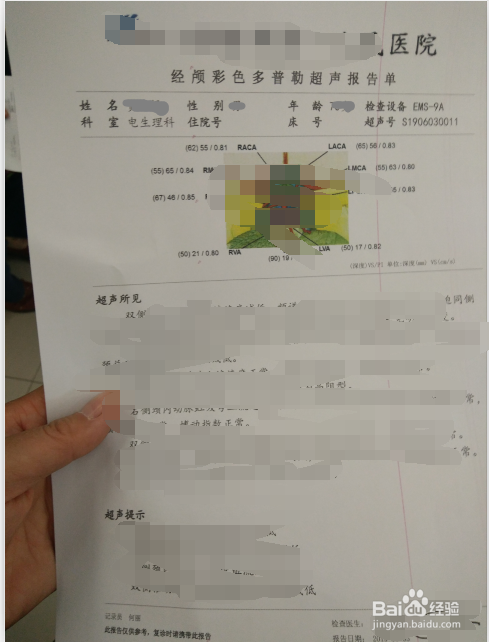 去医院进行颈颅多普勒检查的流程
