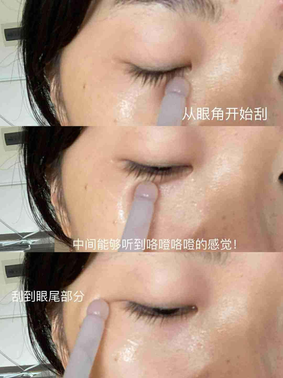 肿泡眼黑眼圈必看,这么做真能淡化黑眼圈
