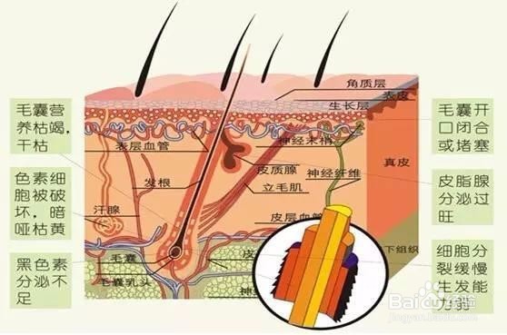 脂溢性脱发简单便宜又好用的生发方法