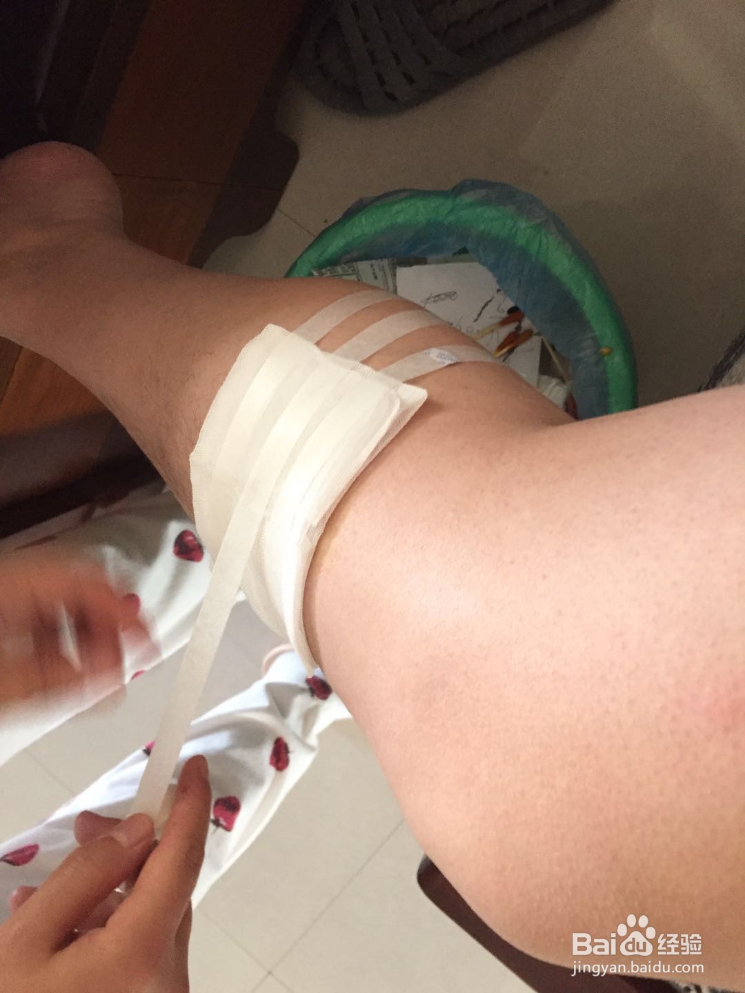 身体出现物品划伤如何处理