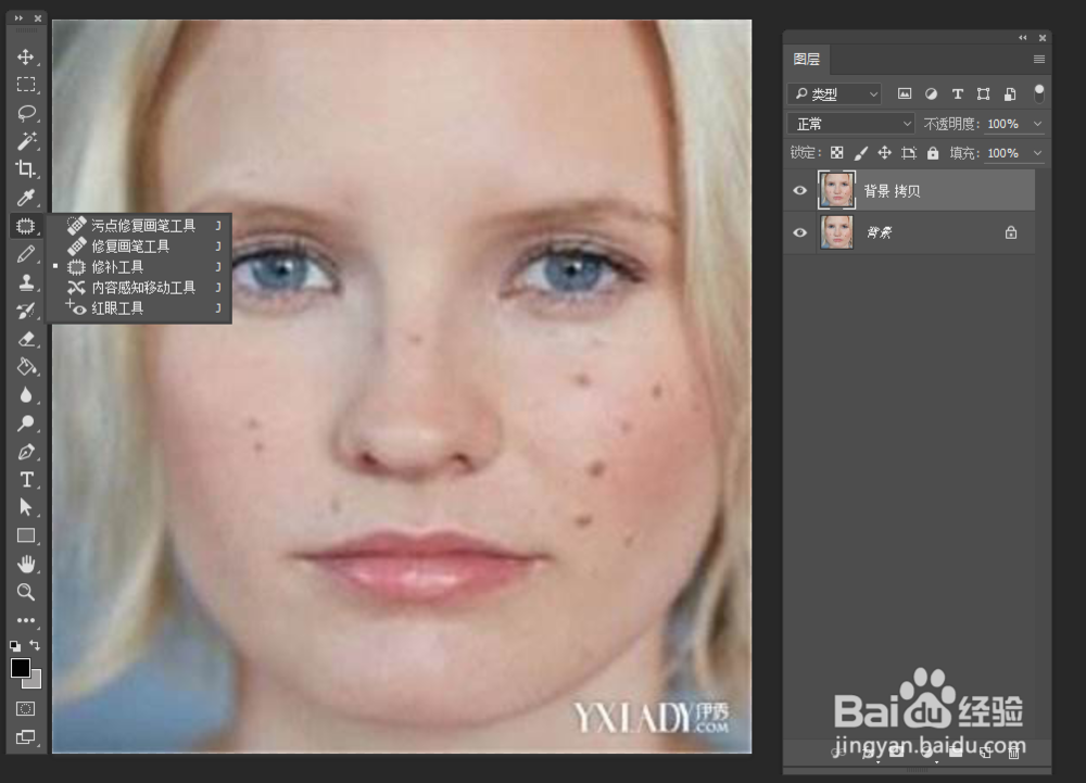 如何利用ps简单去除明显痘痘
