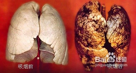 抽烟的人更容易感染H7N9吗