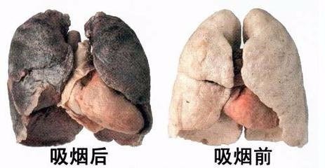 怎么才能戒除烟瘾