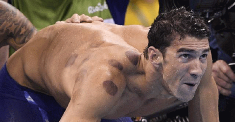 我买的的玻璃拔罐器,为什么吸不住皮肤。