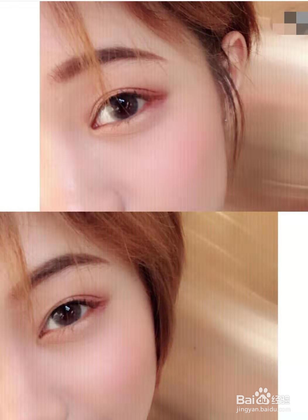 如何快速消除水肿